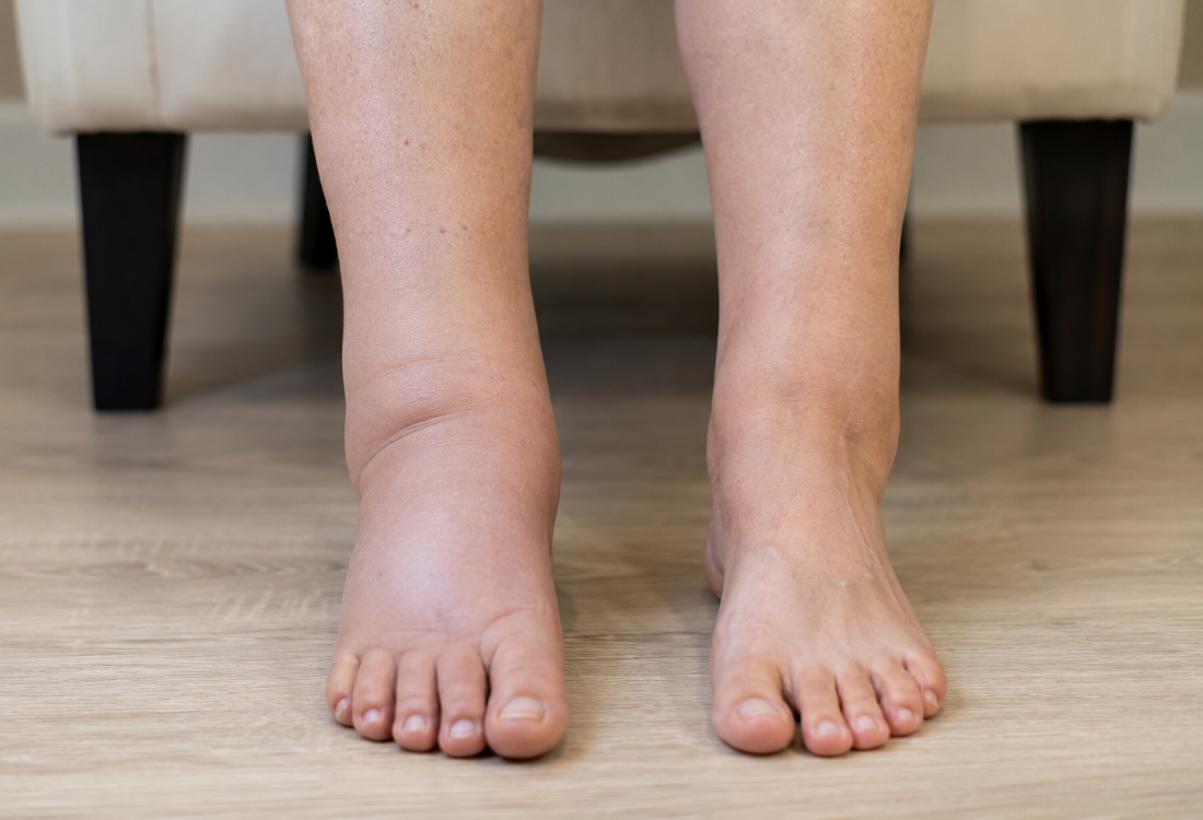 3 Best Foot Spas for Water Retention: How They Help, Features & What to Expect