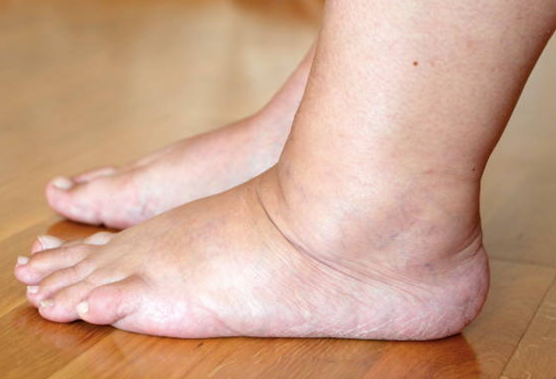 3 Best Foot Baths for Edema Relief in 2026