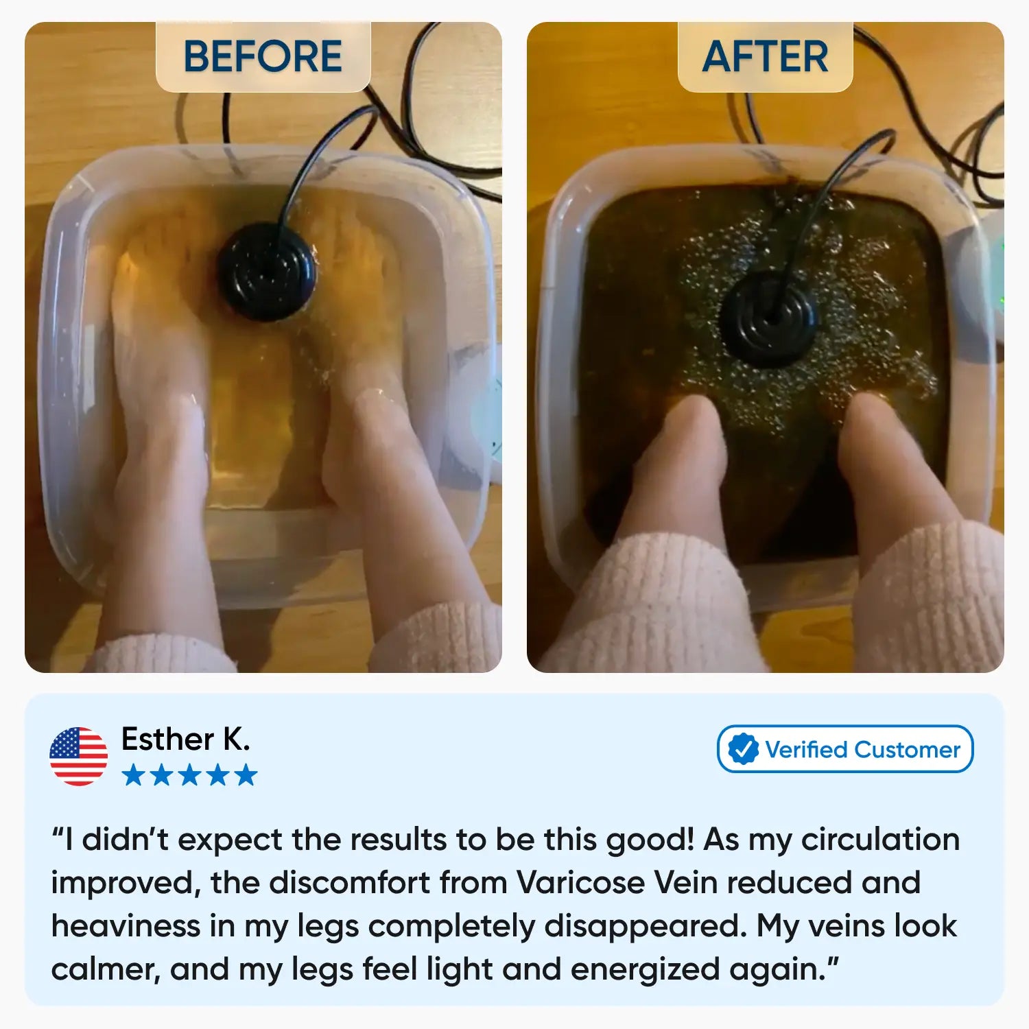 Healifeco Ionic Foot Spa | Support Healthy Circulation & Reduce Varicose Vein Naturally